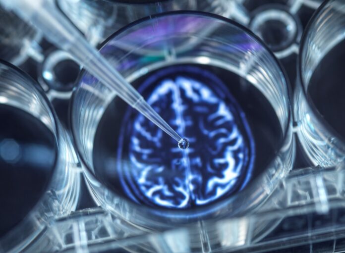 Especialista de Cleveland Clinic asegura que las mujeres generalmente viven más que los hombres, por lo que la edad es un factor de riesgo importante para la enfermedad de Alzheimer