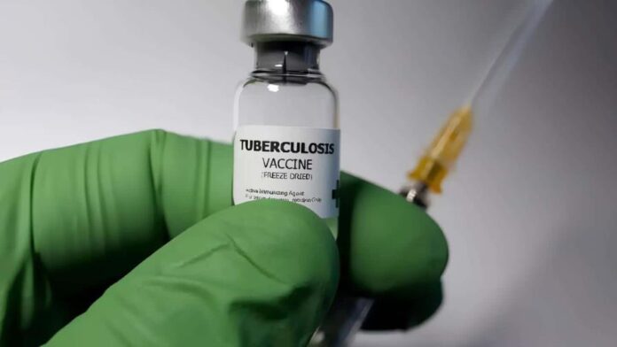 Desarrollan un mecanismo para hacer más eficaz la vacuna contra la tuberculosis. (FUENTE EXTERNA)